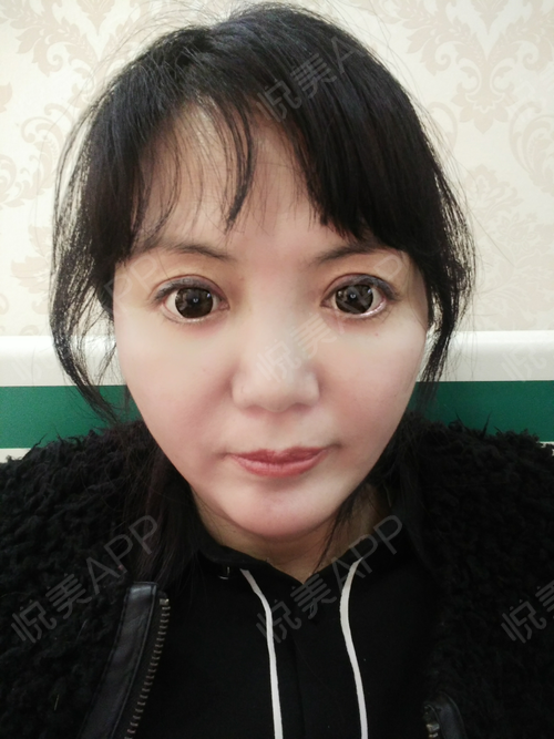 都说女人一枝花鼻子来当家,我的塌鼻子再不拯救就老了