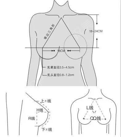 美胸有标准,假体隆胸如何打造完美胸型?